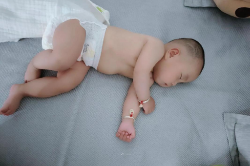 南宁宝宝头上长痱子